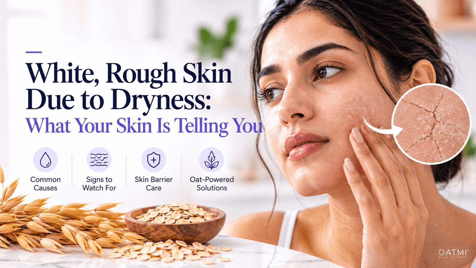 White rough skin due to dryness with visibly cracked and flaky skin, OATMI Skin Science